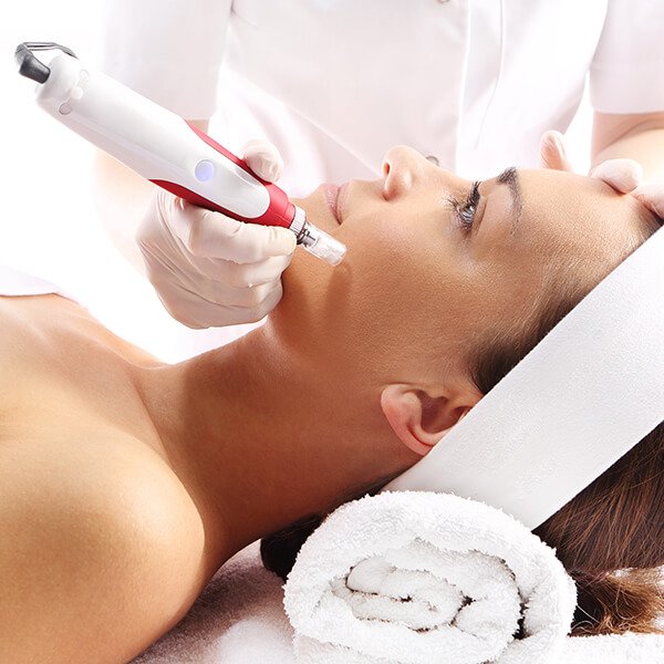 Featured image for “Microneedling”